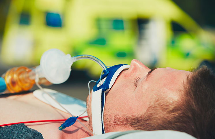 Sunburn Sunburn Jokes Times