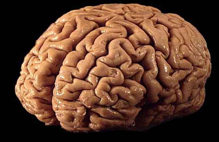 Brain Transplant Brain Transplant Jokes Times